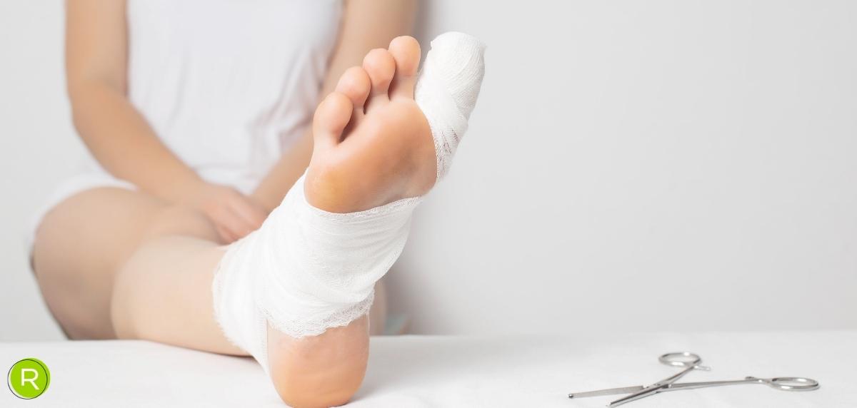  lesiones más frecuentes en el dedo gordo del pie: Fractura de estrés metatarsiana - foto 3