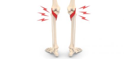 Popliteal tendonitis or pain behind the knee: causes, symptoms, treatment and prevention