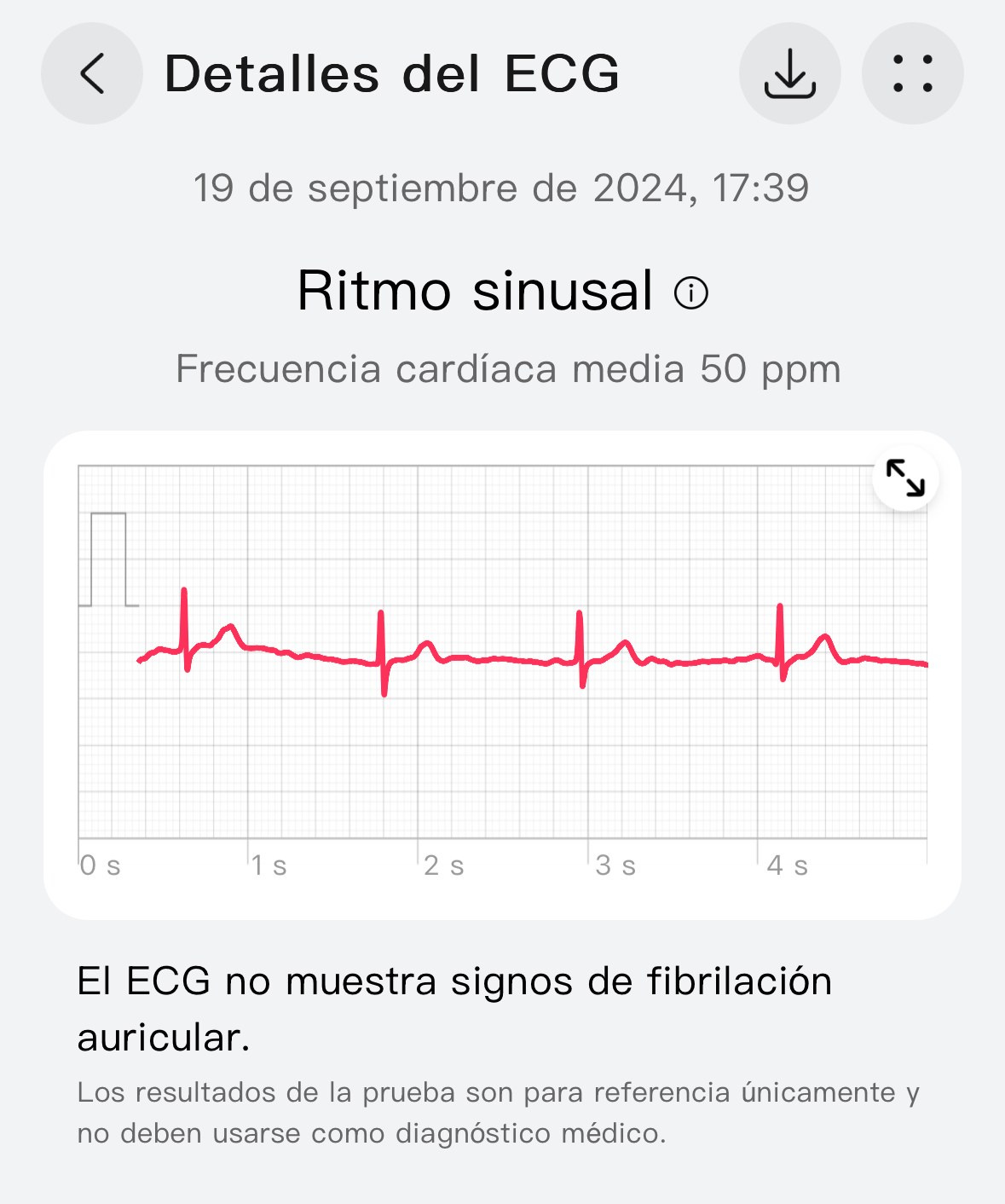 Huawei watch GT 5 pro avis ecg